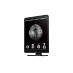 Medigenic MS-S500 computer monitor 54,1 cm (21.3") 2048 x 2560 Pixels WQSXGA LCD Zwart