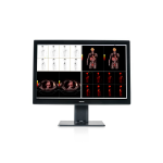 Barco MDCC-6530 computer monitor 77.2 cm (30.4") 3280 x 2048 pixels 4K Ultra HD Black, White