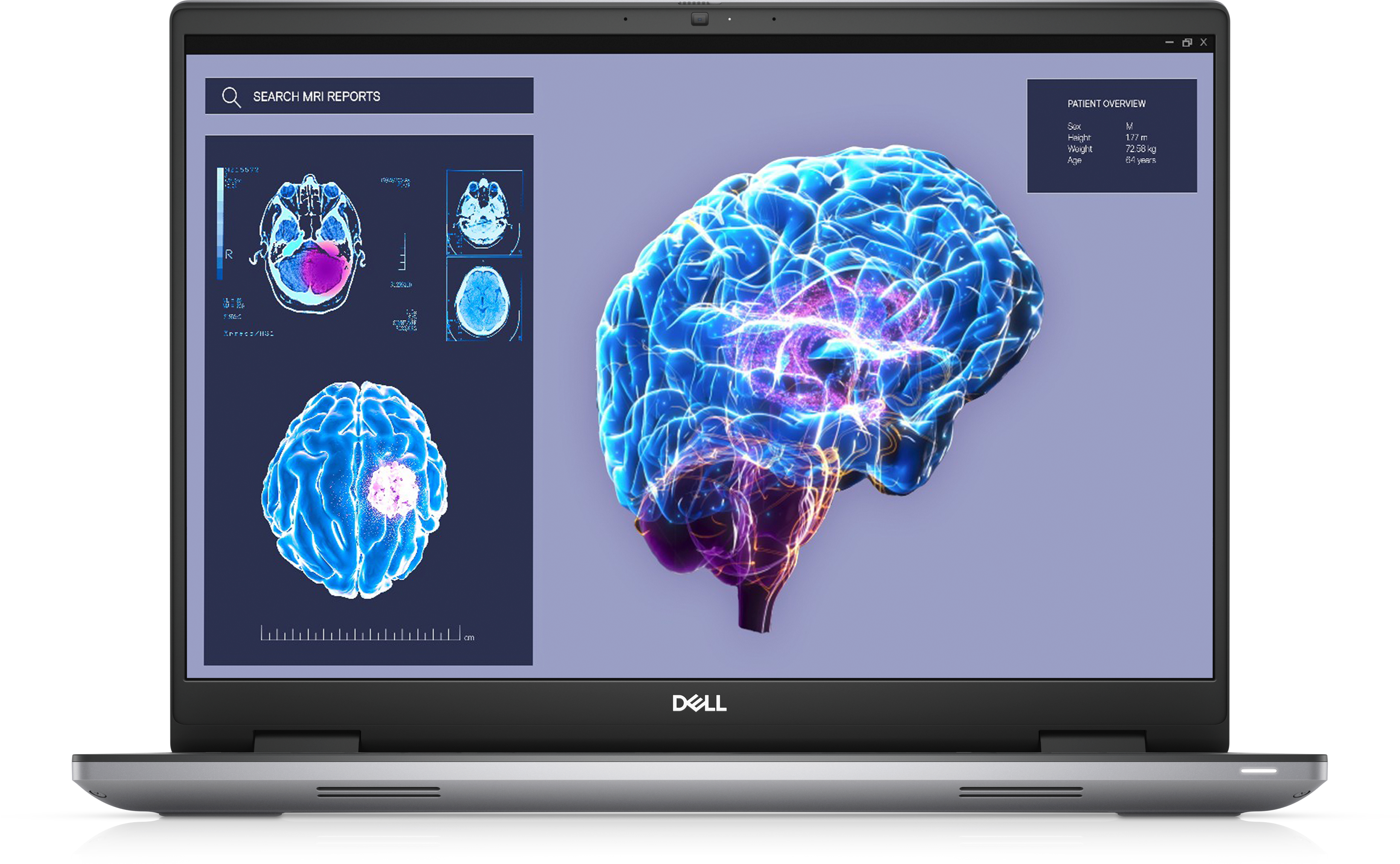 Image of DELL Precision 7680 Mobile workstation 40.6 cm (16") Full HD+...