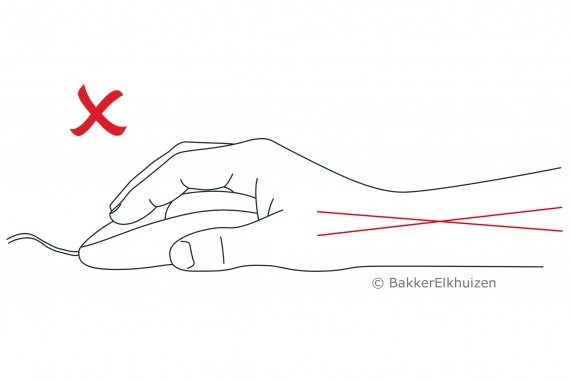 BakkerElkhuizen Evoluent4 Mouse (Right Hand)
